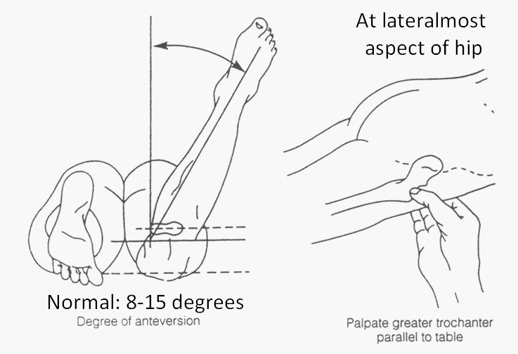 File:Craigs test.jpg