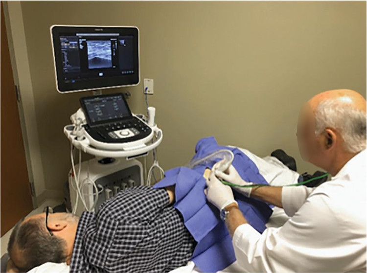 File:Gluteus medius minimus percutaneous tenotomy needle probe and patient position.jpeg