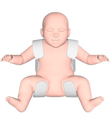 File:Coxa splint.jpg