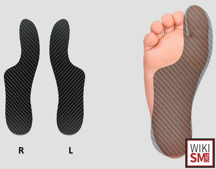 File:Morton shoe great toe.jpeg