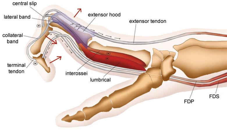 File:Intrinsic minus illustration.jpg