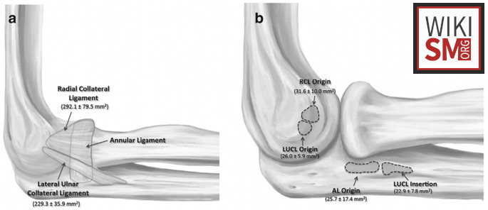 File:LCL ligament injury.jpeg