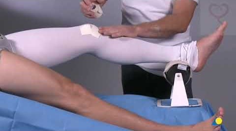 File:Stockinette distribution for the leg cylinder cast.jpg