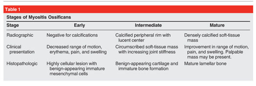 File:Myositis ossificans staging.jpg