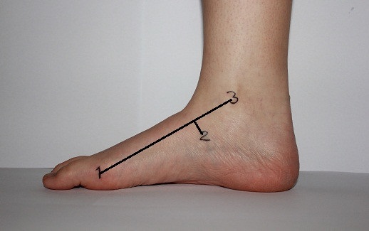 File:Feiss line test.jpg
