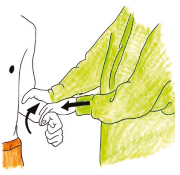 File:Yergason's test for biceps tendon instability or tendonitis.jpg