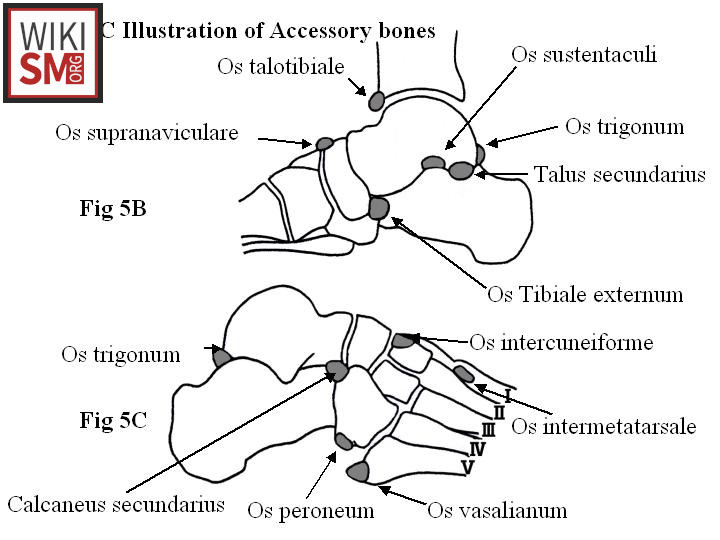 File:Accessory bones foot ankle lateral.jpeg