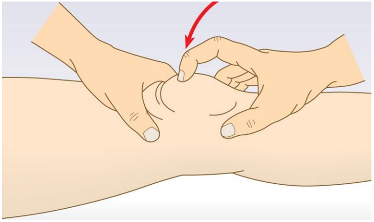 File:Balloon sign knee.jpg