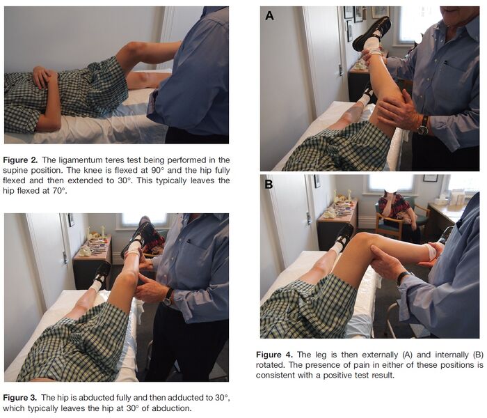 File:Ligamentum teres test.jpg