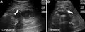 Thumbnail for version as of 23:21, 22 June 2025