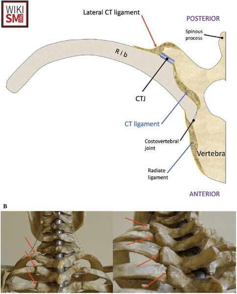 File:Costovertebral angle ligament anatomy.jpeg