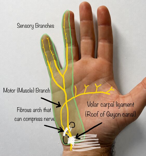 File:Guyon Canal Anatomy.jpg