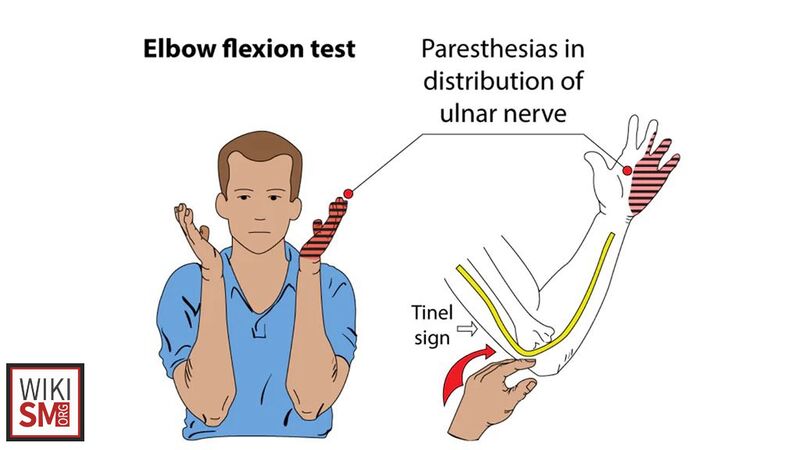 File:Elbow flexion test.jpg