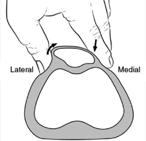 File:Knee patellar tilt test.jpg