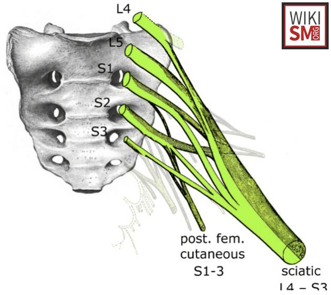 File:Sciatic nerve lumbosacral plexus.jpeg