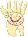 Normal anatomy of the carpal bones. Diagram of the wrist (frontal view) shows the eight carpal bones and the three carpal arcs (Gilula arcs), which are shown as pink (arc I), blue (arc II), and red (arc III) lines. C (capitate), H (hamate), L (lunate), P (pisiform), S (scaphoid), Tm (trapezium), Td (trapezoid), Tr (triquetrum)[4]