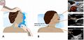 Thumbnail for version as of 13:19, 12 May 2026