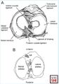 (A) Anatomy of the meniscus viewed from above (B) Axial view of a right tibial plateau showing sections of the meniscus and their relationship to the cruciate ligaments. AL, anterior horn lateral meniscus; AM, anterior horn medial meniscus; PCL, posterior cruciate ligament; PL, posterior horn lateral meniscus; PM, posterior horn medial meniscus.[2]