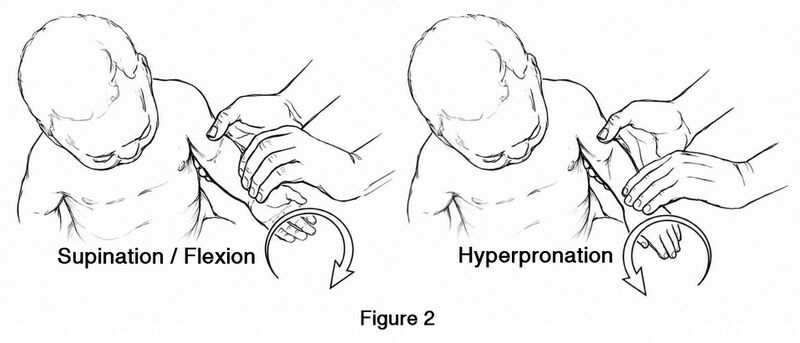 File:Nursemaids elbow reduction.jpg