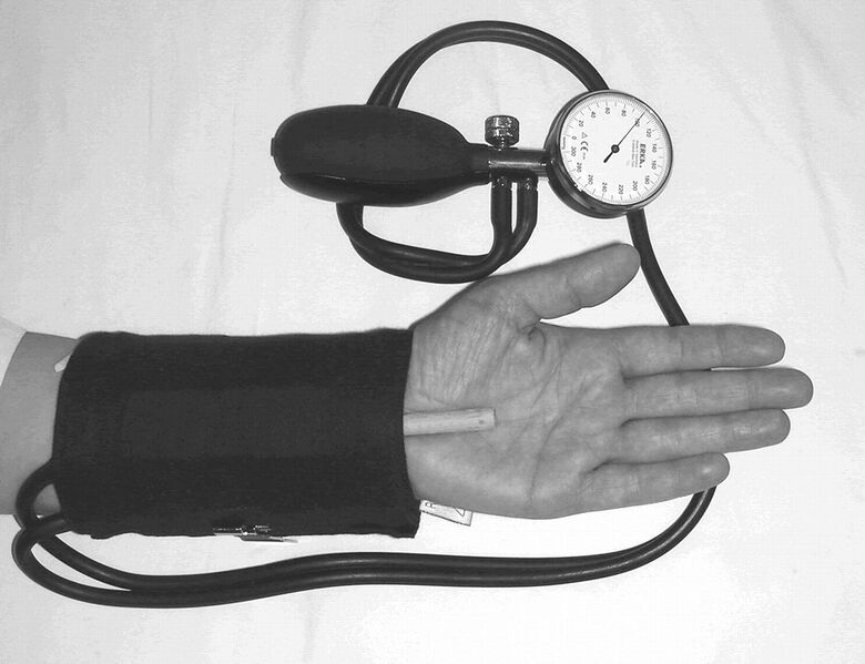 File:Gilliatt Test carpal tunnel.jpg