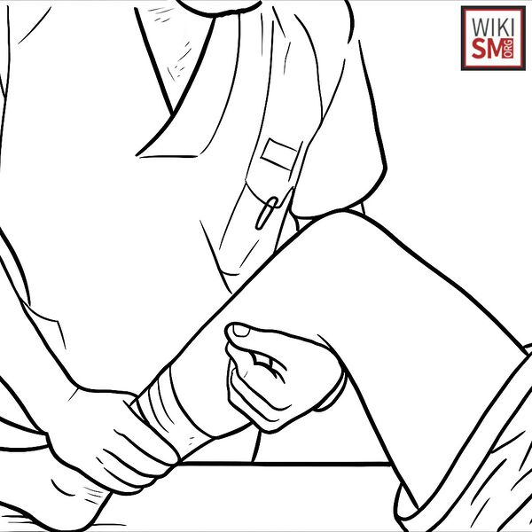 File:Finochietto sign ACL meniscus.jpeg