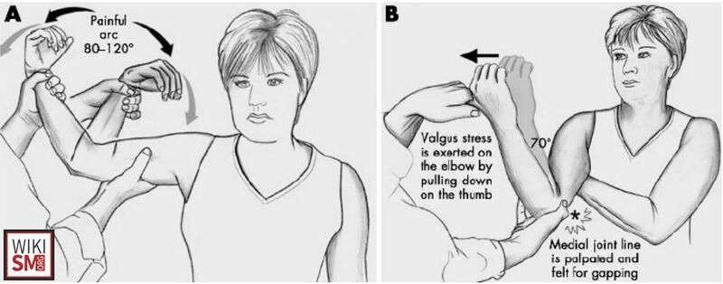 File:O’Driscoll Moving Valgus Test.jpeg