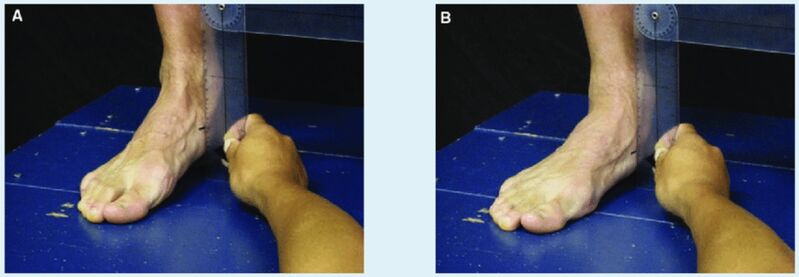 File:Navicular drop test.jpg