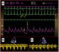 Thumbnail for version as of 15:03, 16 July 2026