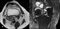 Thumbnail for version as of 15:00, 3 June 2026