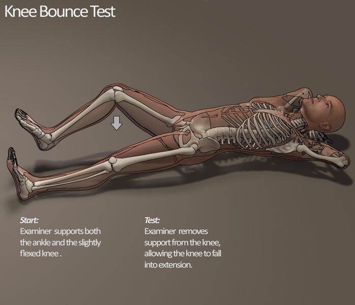 File:Knee bounce test.jpg
