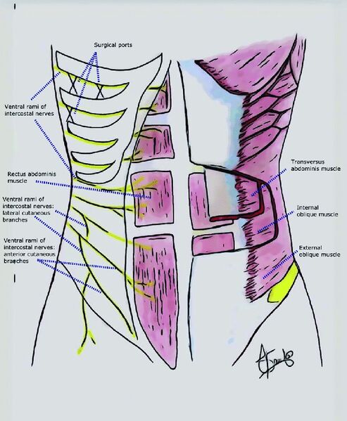 File:Rectus abdominis nerve supply.jpg
