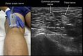 Thumbnail for version as of 14:35, 10 April 2025