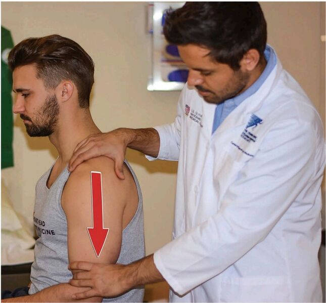 File:Sulcus sign shoulder.jpg