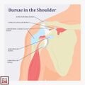 Bursae of the shoulder