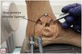 Medial view of a caveric ankle showing an intact deep posterior tibiotalar ligament. The superficial and deep anterior deltoid ligament bands are removed.[4]