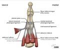 The anatomy of the plantar aspect of the 1st MTP joint is illustrated and labeled[1]