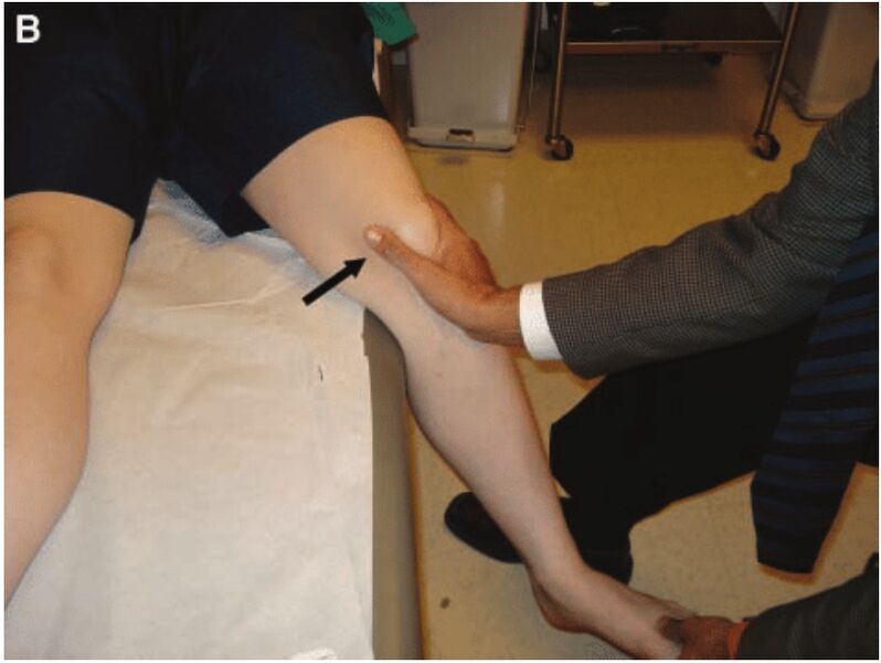 File:Moving patellar apprehension test.jpg