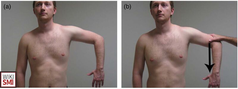 File:Shoulder lateral jobe test.jpeg