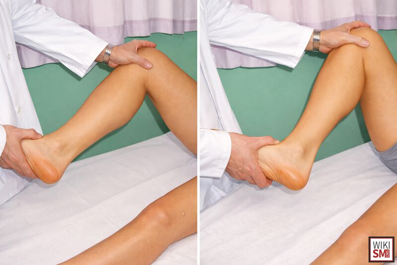 File:Mcmurray test knee exam.jpeg