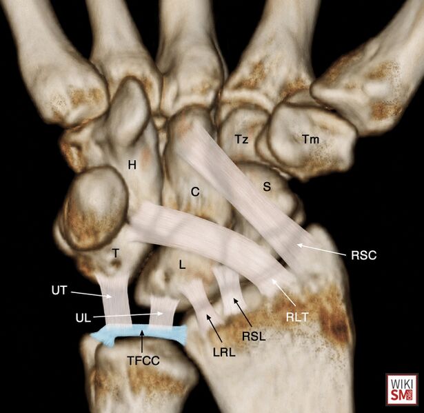 File:Volar extrinsic ligaments wrist.jpeg