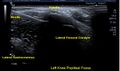 Thumbnail for version as of 03:26, 16 April 2025