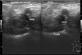 Thumbnail for version as of 15:09, 23 July 2025