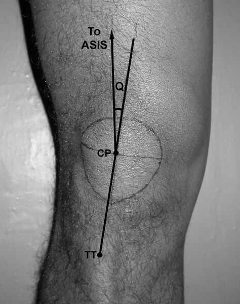 File:Knee Q angle.jpg