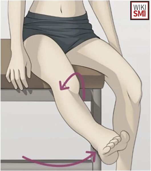 File:Patellar j sign.jpeg