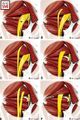 Anatomic variations of the relationship between the piriformis muscle and sciatic nerve. (a) An undivided nerve emerges below the piriformis muscle (normal course)[4]