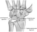 Illustration of the lunotriquetral ligament[3]