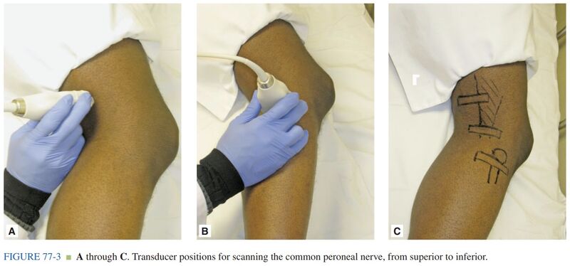 File:CPN injection sites.jpg