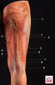 Sciatic nerve (1) and its muscular branches (2); perforating branches of the deep femoral artery (3). Semitendinosus (4) and semimembranosus muscles (5), biceps femoris (6), popliteal vein (7), popliteal artery (8), common fibular nerve (9)[1]