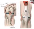 Patellofemoral joint anatomy