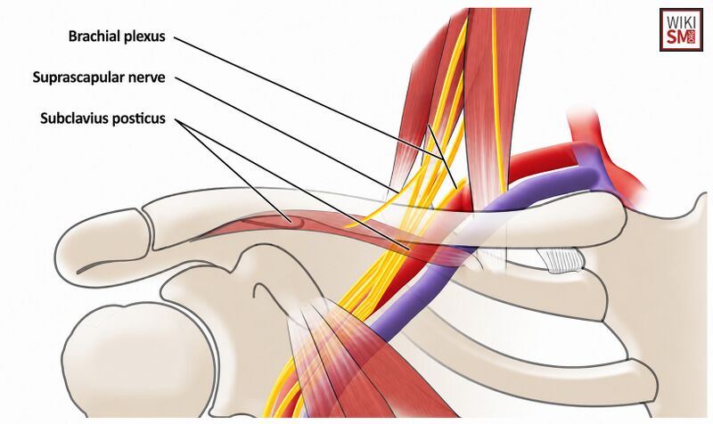 File:Subclavius posticus anatomy.jpeg